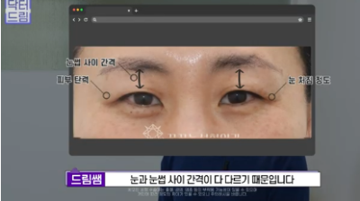 이번 명절 선물은 며느리 몰래 젊어지는 중년성형으로 하세요 사진 7