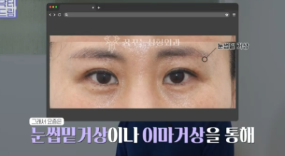 이번 명절 선물은 며느리 몰래 젊어지는 중년성형으로 하세요 사진 8
