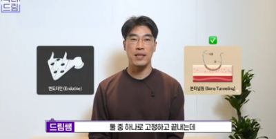더 새로워지고 더 강력해진, 꼭 알아야하는 2026 중년성형트렌드 사진 15