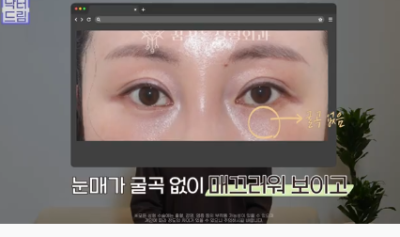 더 새로워지고 더 강력해진, 꼭 알아야하는 2026 중년성형트렌드 사진 8