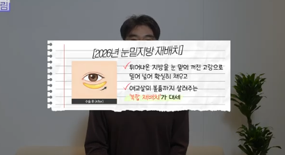 더 새로워지고 더 강력해진, 꼭 알아야하는 2026 중년성형트렌드 사진 3