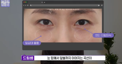 더 새로워지고 더 강력해진, 꼭 알아야하는 2026 중년성형트렌드 사진 7