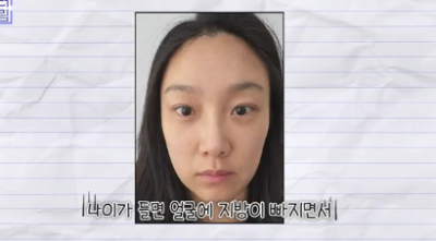 이거 안하면 확늙더라구요. 성형외과원장 부인이 꼭 하는 가성비갑 최애시술 TOP3 사진 26
