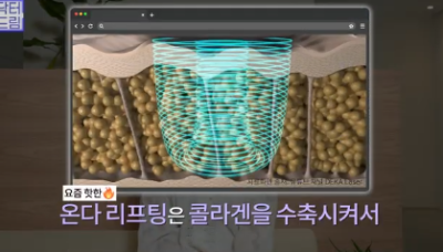 이거 안하면 확늙더라구요. 성형외과원장 부인이 꼭 하는 가성비갑 최애시술 TOP3 사진 12