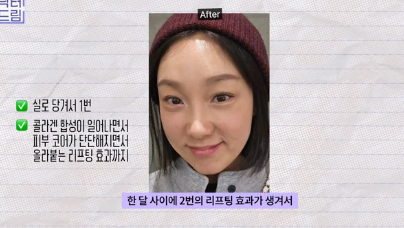 이거 안하면 확늙더라구요. 성형외과원장 부인이 꼭 하는 가성비갑 최애시술 TOP3 사진 24