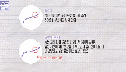 이거 안하면 확늙더라구요. 성형외과원장 부인이 꼭 하는 가성비갑 최애시술 TOP3 사진 19