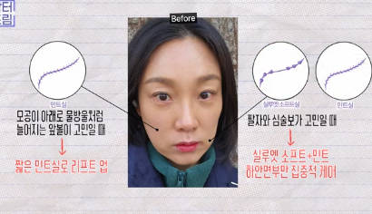 이거 안하면 확늙더라구요. 성형외과원장 부인이 꼭 하는 가성비갑 최애시술 TOP3 사진 20
