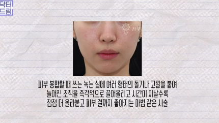 이거 안하면 확늙더라구요. 성형외과원장 부인이 꼭 하는 가성비갑 최애시술 TOP3