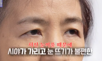 성형외과실장은 판매왕?4060 중년성형 폭망하지않으려면 이런 병원은 피하세요 사진 2
