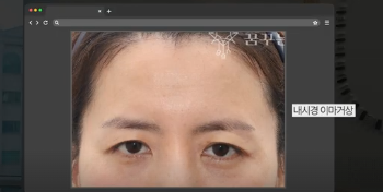 이번 연휴, 남들 쉴 때 예뻐질 결심! 기간별 성형족보총정리(feat.어버이날 선물) 사진 25