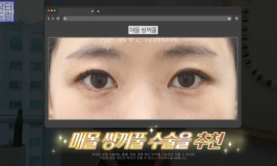 이번 연휴, 남들 쉴 때 예뻐질 결심! 기간별 성형족보총정리(feat.어버이날 선물) 사진 7