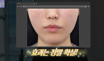 이번 연휴, 남들 쉴 때 예뻐질 결심! 기간별 성형족보총정리(feat.어버이날 선물) 사진 4