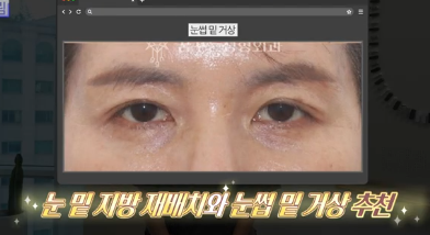 이번 연휴, 남들 쉴 때 예뻐질 결심! 기간별 성형족보총정리(feat.어버이날 선물) 사진 11