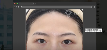 이번 연휴, 남들 쉴 때 예뻐질 결심! 기간별 성형족보총정리(feat.어버이날 선물) 사진 21