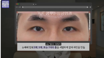 "진작 할걸" 싶은 남자상안검 한끗차이, 사진으로 확인하세요.