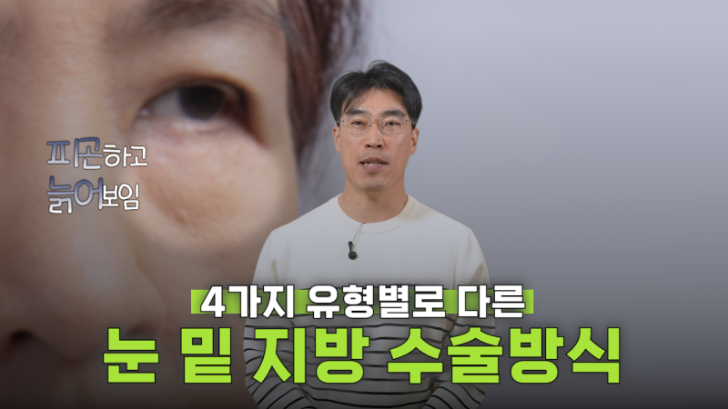 유형별로 다른 눈밑지방재배치 핵심가이드, 실패하는 이유 알고 가세요