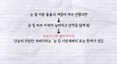 90%가 실패하는 눈밑지방재배치 4가지 이유 사진 13