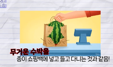 중년쌍꺼풀, 상안검 하면 안되는 눈이 있습니다! 사진 17