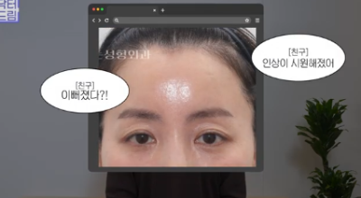 중년쌍꺼풀, 상안검 하면 안되는 눈이 있습니다! 사진 10