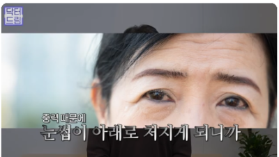 중년쌍꺼풀, 상안검 하면 안되는 눈이 있습니다!