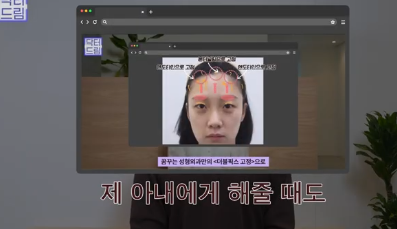 중년쌍꺼풀, 상안검 하면 안되는 눈이 있습니다! 사진 15