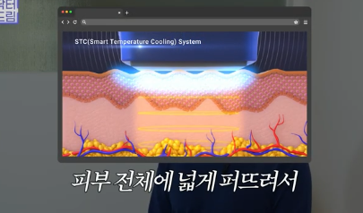 실제로 해보니 정말 효과있었던 탄력레이저는 이겁니다(울쎄라,텐써마,티타늄,온다,포텐자) 사진 6