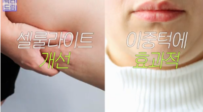 실제로 해보니 정말 효과있었던 탄력레이저는 이겁니다(울쎄라,텐써마,티타늄,온다,포텐자) 사진 14