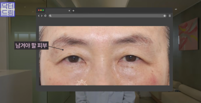 하안검 잘못하고 눈물 흘리는 친구 보고 깨달은 꿀팁 사진 9