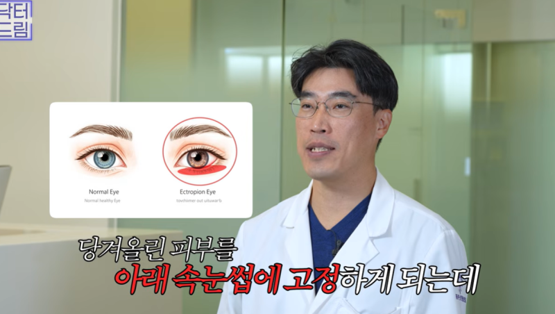 하안검 잘못하고 눈물 흘리는 친구 보고 깨달은 꿀팁 사진 12