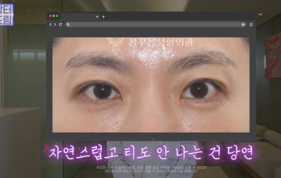 하안검 잘못하고 눈물 흘리는 친구 보고 깨달은 꿀팁 사진 8