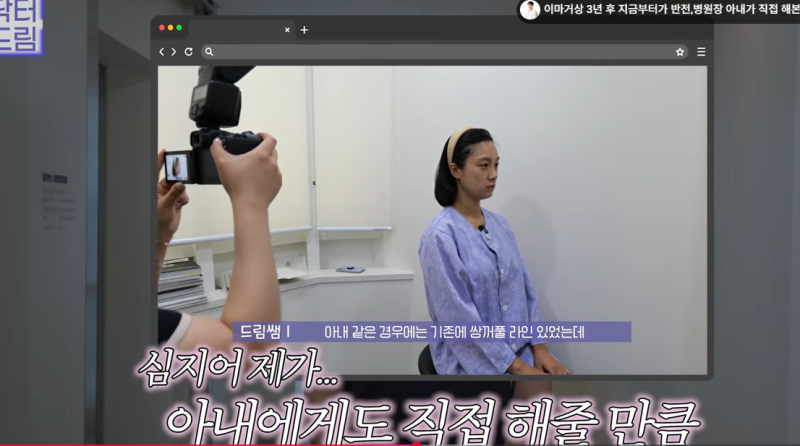 눈 성형 후 사나워진 얼굴, 딱 1가지가 똑같습니다 사진 17