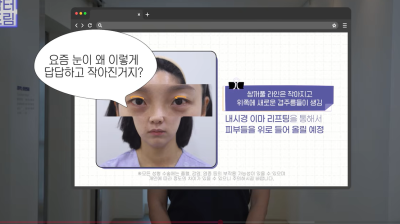 눈 성형 후 사나워진 얼굴, 딱 1가지가 똑같습니다 사진 18