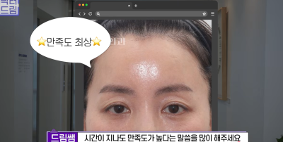 눈 성형 후 사나워진 얼굴, 딱 1가지가 똑같습니다 사진 26
