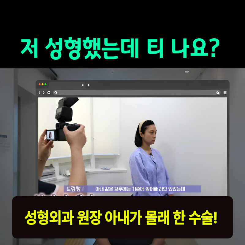 눈 성형 후 사나워진 얼굴, 딱 1가지가 똑같습니다