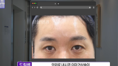 눈 성형 후 사나워진 얼굴, 딱 1가지가 똑같습니다 사진 16