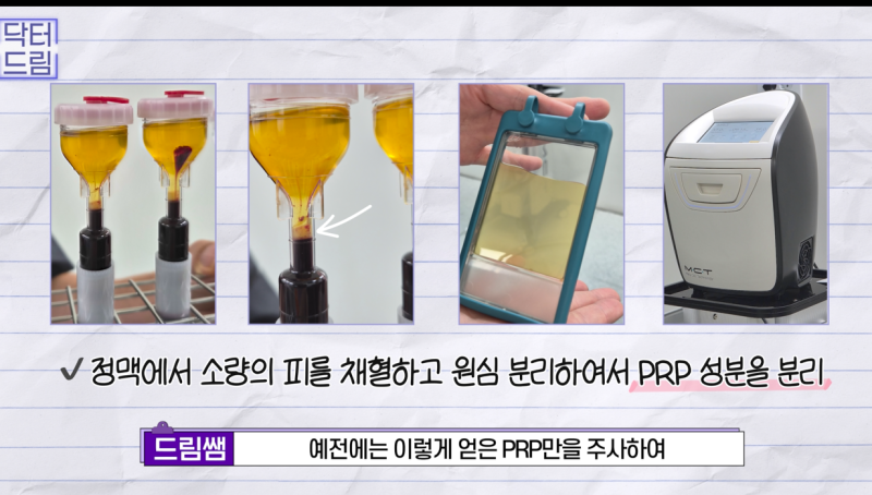 가짜 엑소좀 그만 맞고 진짜 엑소좀을 하세요 사진 5