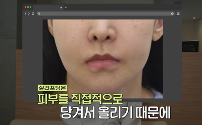 효과는 즉시! 유지기간은 2배 늘리는 숨겨진 시술 비밀 사진 12