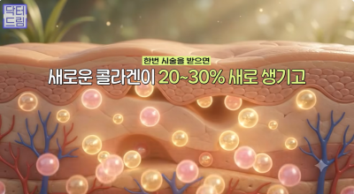 효과는 즉시! 유지기간은 2배 늘리는 숨겨진 시술 비밀 사진 6