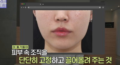 효과는 즉시! 유지기간은 2배 늘리는 숨겨진 시술 비밀 사진 10