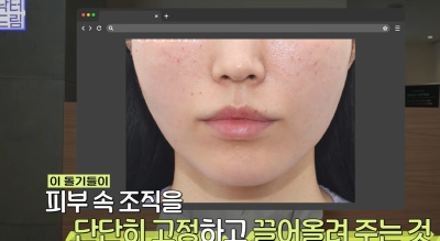 효과는 즉시! 유지기간은 2배 늘리는 숨겨진 시술 비밀 사진 11