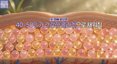 효과는 즉시! 유지기간은 2배 늘리는 숨겨진 시술 비밀 사진 7