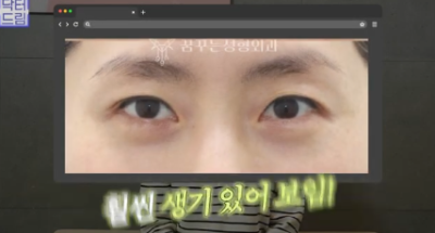 전현무도 한 중년수술, 이게 현실입니다 사진 5