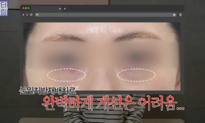 전현무도 한 중년수술, 이게 현실입니다 사진 9