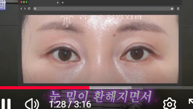 전현무도 한 중년수술, 이게 현실입니다 사진 18