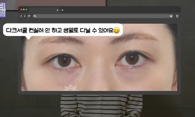 전현무도 한 중년수술, 이게 현실입니다 사진 19