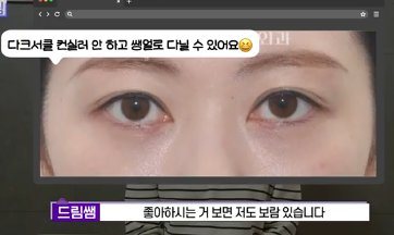 전현무도 한 중년수술, 이게 현실입니다 사진 20