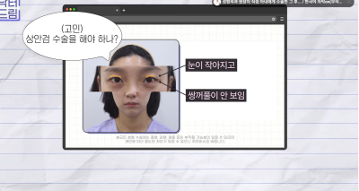 1000명 상안검수술 해준 의사가 아내는 안해준 이유 사진 13