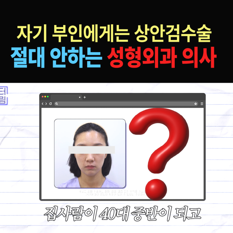 1000명 상안검수술 해준 의사가 아내는 안해준 이유